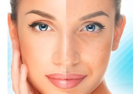 «Ученые лаборатории Estenity LAB Rus разработали инновационный подход к лечению проблемной кожи – акне, воспалениям и черным точкам на лице»