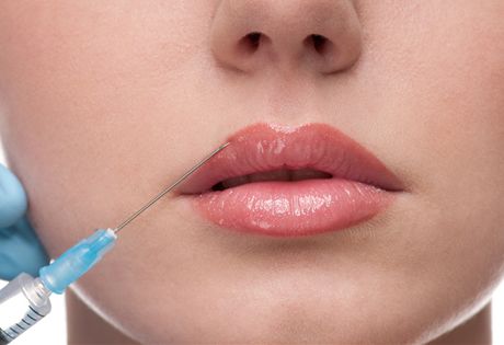Все, что Вы должны знать прежде, чем решиться на контурную пластику губ