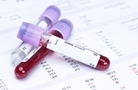 Простой анализ крови поможет оценить риск диабета и проблем с сердцем в будущем